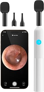 Kit De Exame Ouvido, Nariz E Garganta Baby Com Câmera Hd, Escopo Entidade Doméstica 6 Luzes Led,